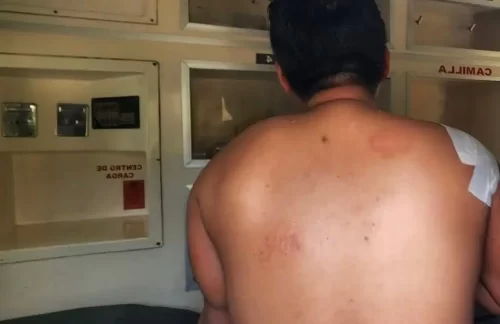 Hombre resulta gravemente herido tras presunta agresión con arma blanca en Papantla
