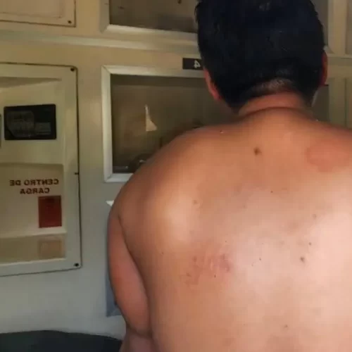 Hombre resulta gravemente herido tras presunta agresión con arma blanca en Papantla