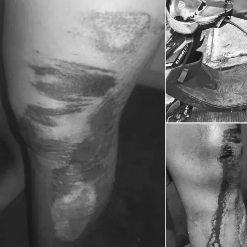 Pareja de motociclistas resulta lesionada tras accidente en la Carretera Federal 180
