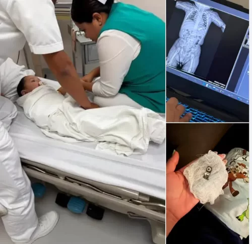Bebé sobrevive tras ingerir pieza de un portachupón; madre llama a extremar precauciones