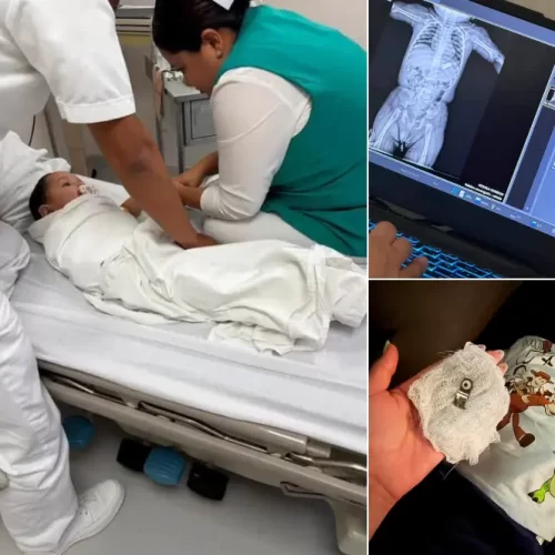Bebé sobrevive tras ingerir pieza de un portachupón; madre llama a extremar precauciones